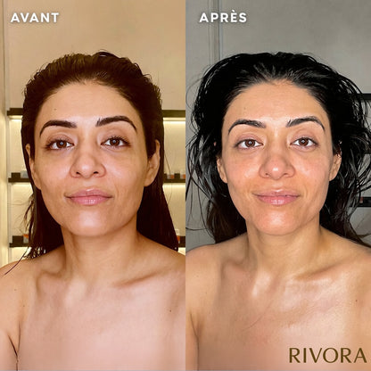 Brosse Visage Lymphatique Rivora